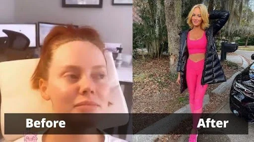 Kathryn Dennis Before and After
