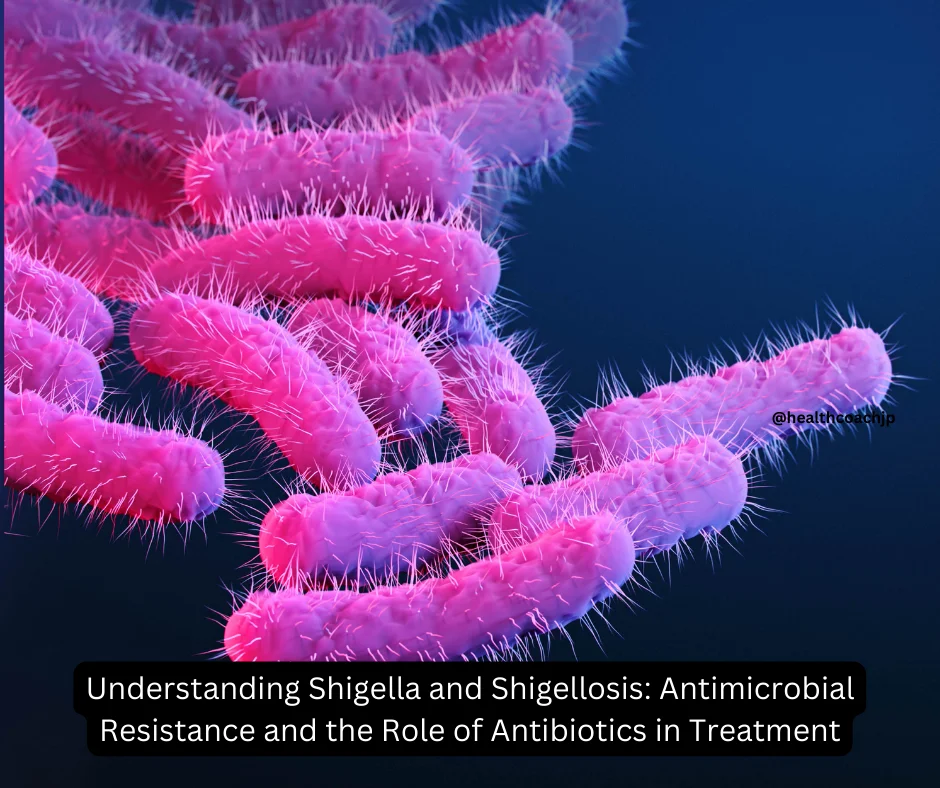 Understanding Shigella And Shigellosis Antimicrobial Resistance And