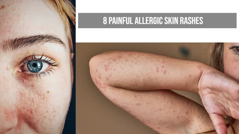 8 Painful Skin Rashes: Recognize & Get Relief Now