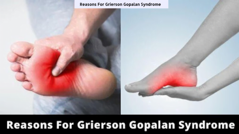 Consulting for Grierson Gopalan Syndrome: Expert Tips & Info