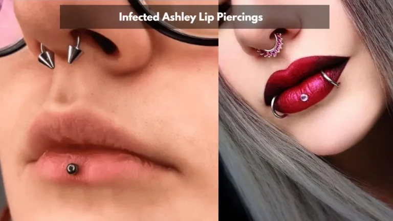 Infected Ashley Lip Piercing: 5 Tips for Healing & Care