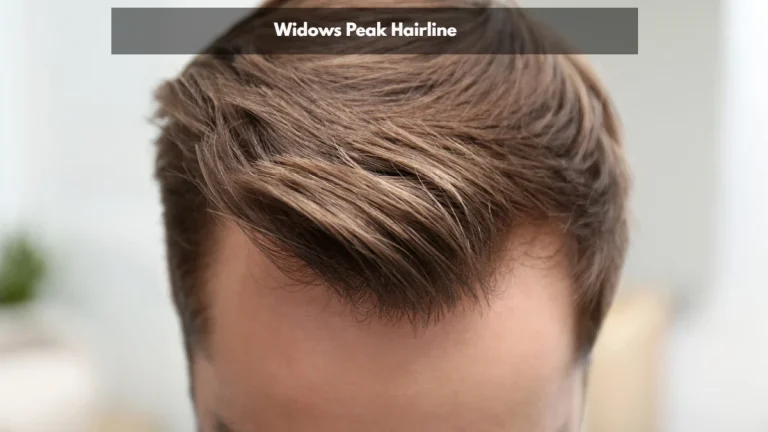 Widows Peak Hairline: 5 Fascinating Reasons Explained