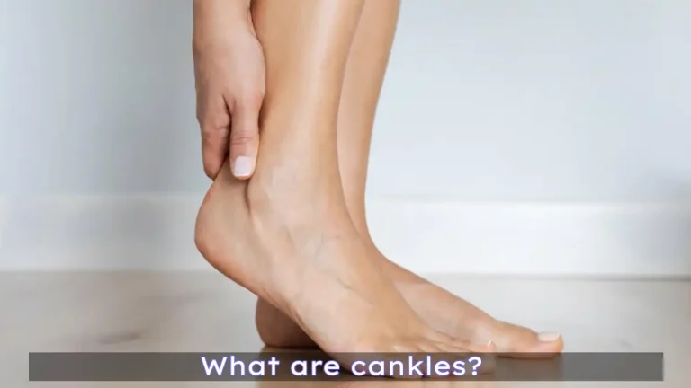 Cankles vs Ankles: Causes & Tips to Get Rid of Cankles