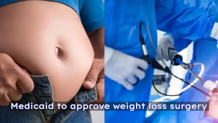 How long does it take Medicaid to approve weight loss surgery?