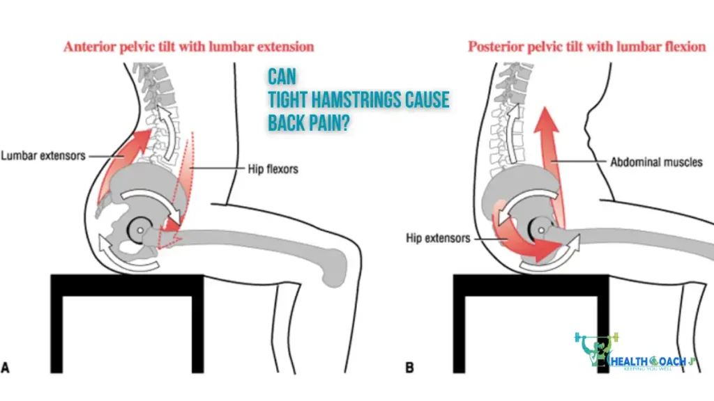 Can Tight Hamstrings Cause Back Pain