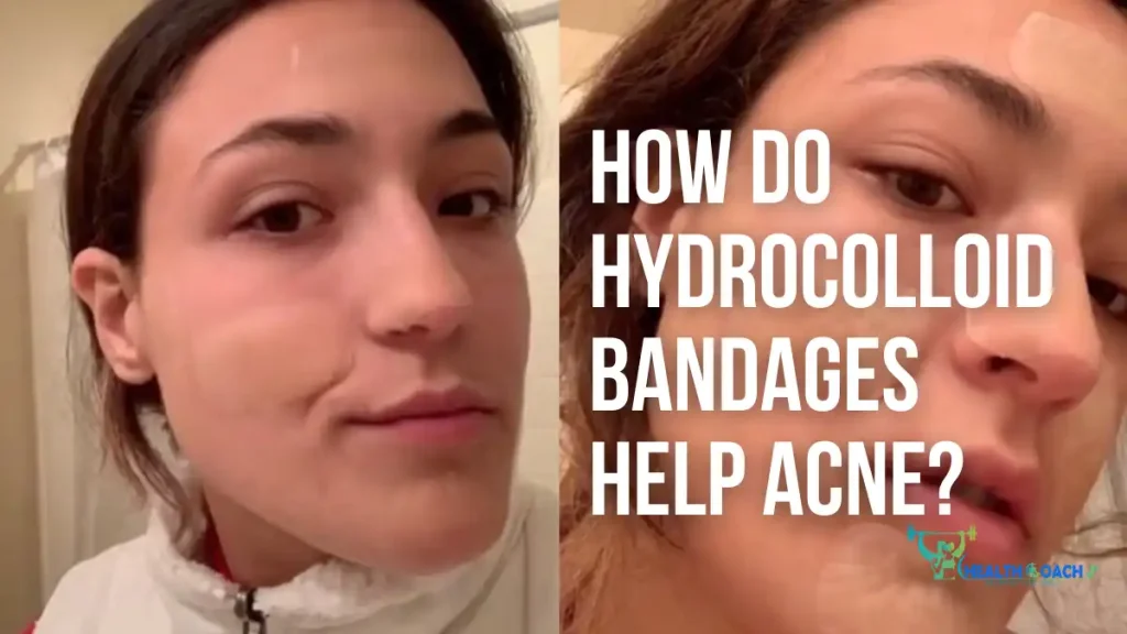 How Do Hydrocolloid Bandages Help Acne