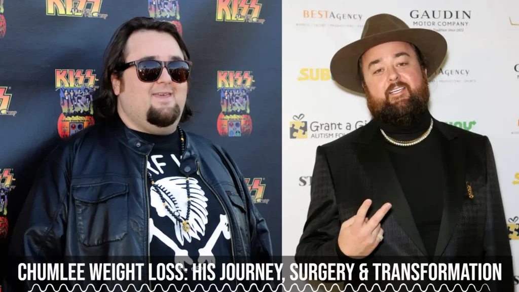 Chumlee Weight Loss ourney, Surgery & Transformation